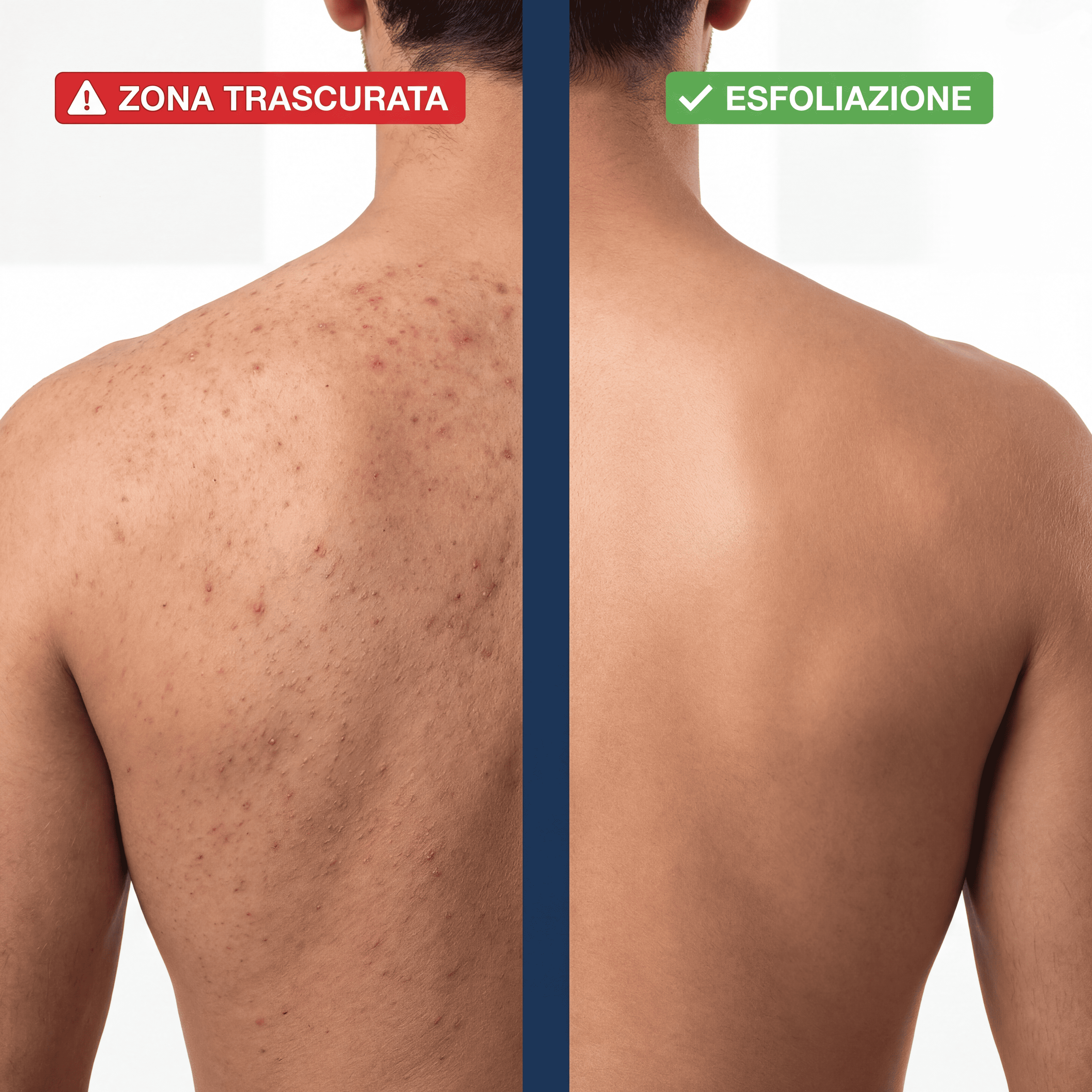 Asciugamano Esfoliante - Olyra