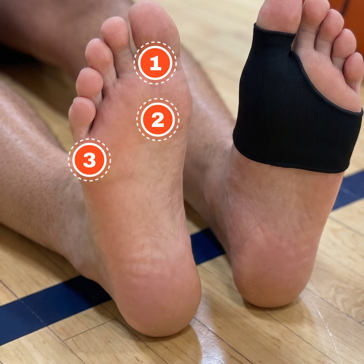 Sole of a bare foot with numbered markers on the big toe, the ball of the foot and the outer forefoot
